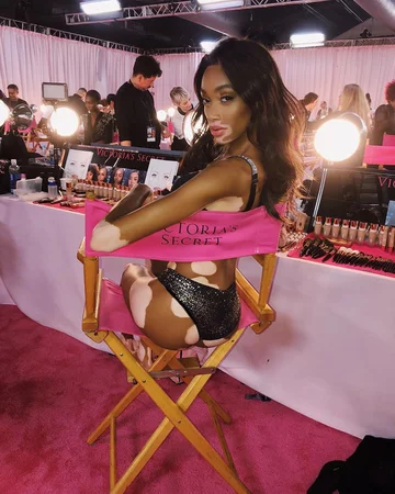 Winnie Harlow - aniołek Victoria's Secret, który cierpi na bielactwo 