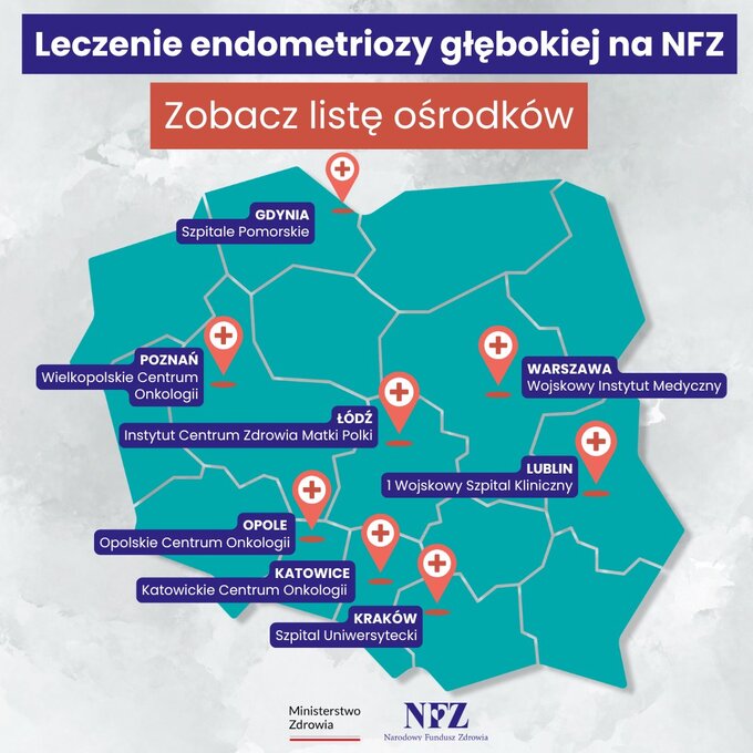 Leczenie endometriozy – mapa ośrodków