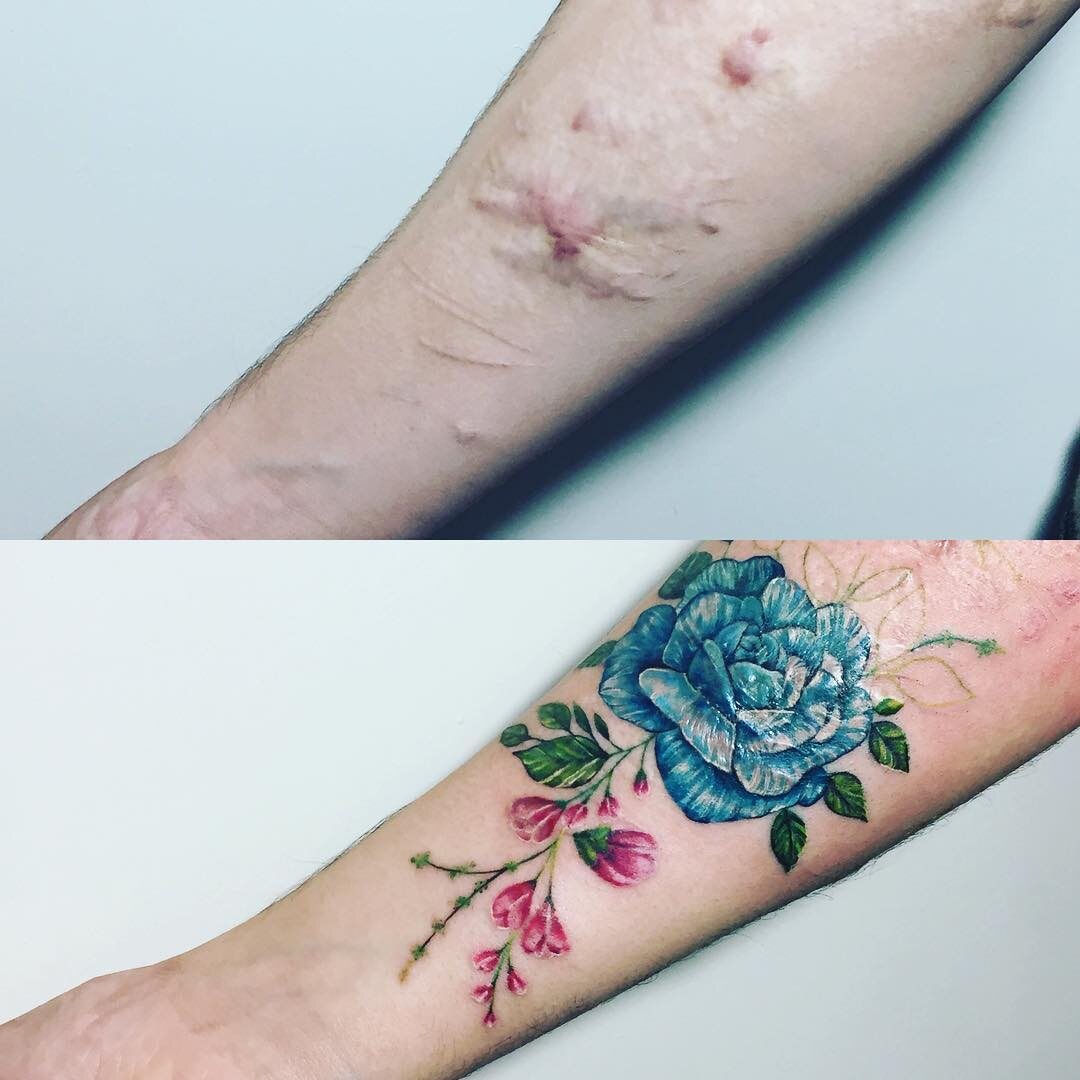 Tatuaż zakrywający blizny 