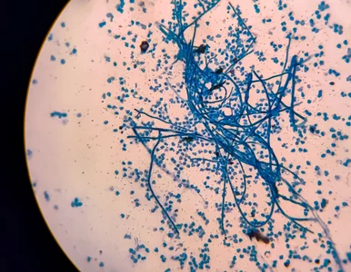 Miniatura: Ten grzyb może zabić miliony. Nadciąga do...