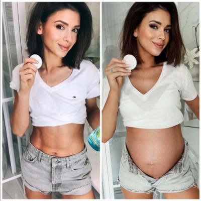 Miniatura: Klaudia Halejcio przed i w trakcie ciąży
