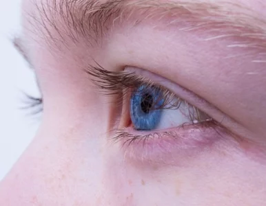 Miniatura: Czy opadająca powieka to schorzenie, które...