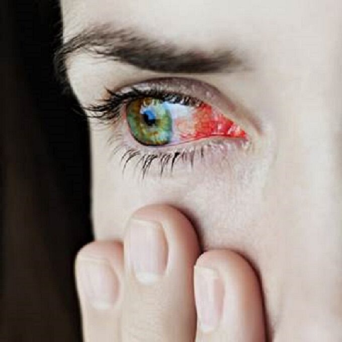 Kolory Oczu Tabela Barw Oczu Dziedziczenie Statystyki Zdrowie Wprost 4040