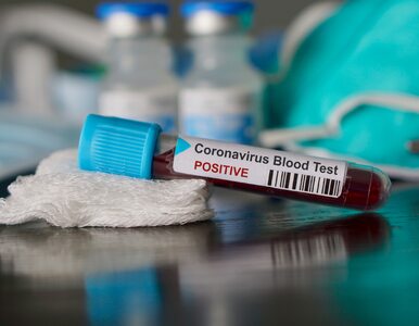 Zamieszanie wokół testów na koronawirusa. Nowe dane Ministerstwa Zdrowia
