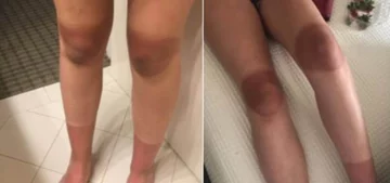 Podarte spodnie i słońce. Oto efekt 