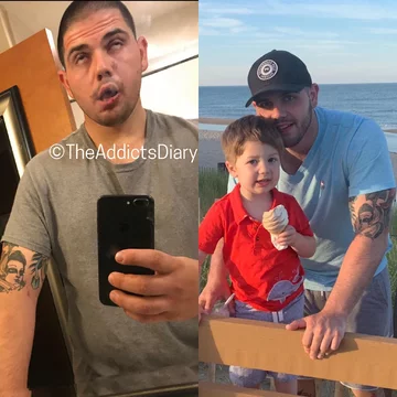 Zdjęcie przed i po wyjściu z nałogu 