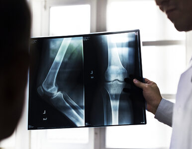 Z powodu epidemii koronawirusa w Polsce pacjenci chorzy na osteoporozę...
