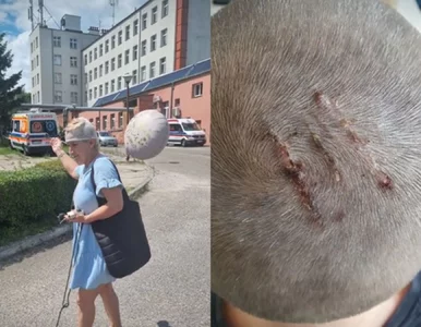Miniatura: O krok od tragedii pod urzędem. Piła...