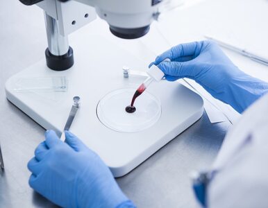 Pięć powodów, żeby zrobić test anty-HCV