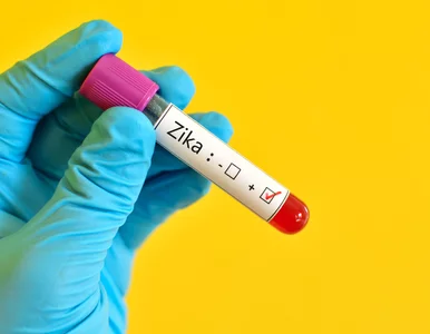 Miniatura: Grypa groźniejsza niż zika