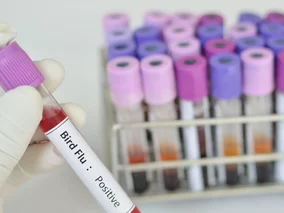 Miniatura: Ptasia grypa tuż za polską granicą....