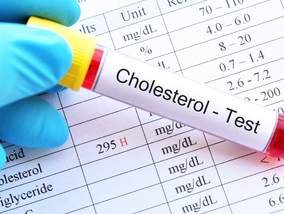 Miniatura: Dobry cholesterol może przyczyniać się...