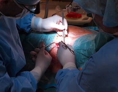 Miniatura: Hydrauliczna proteza prącia wszczepiona....