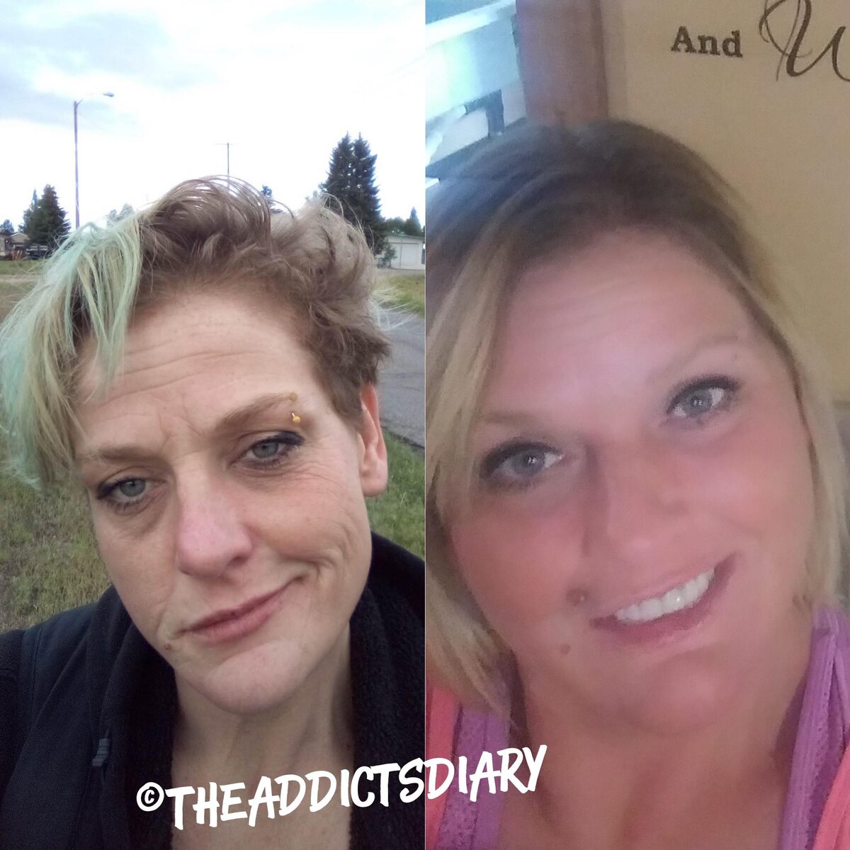 Przed i po odstawieniu narkotyków 