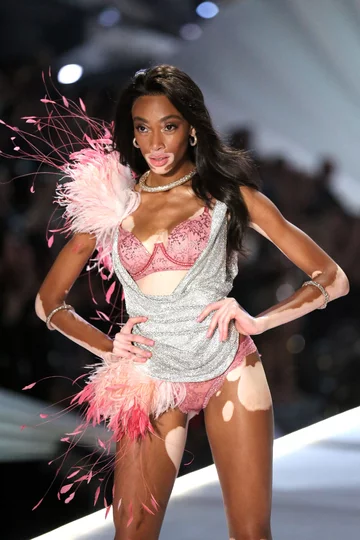 Winnie Harlow na pokazie Victoria's Secret 