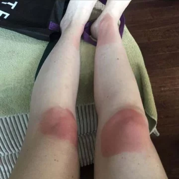 Podarte spodnie i słońce. Oto efekt 