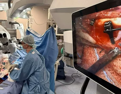 Miniatura: Robot ratuje dłoń pacjenta. Przełomowa...