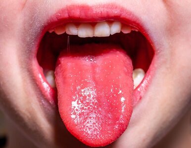 Masz obolały, czerwony język? Może brakować ci tej witaminy