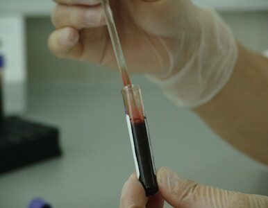 Ile kosztują podstawowe badania krwi prywatnie? Poznaj aktualny cennik