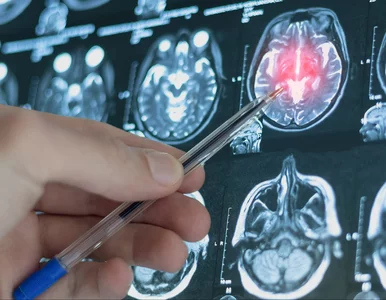 Miniatura: Sztuczna inteligencja pozwoli wcześniej...