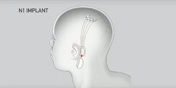 Neurolink 