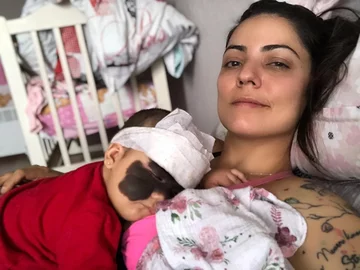 Luna Fenner po zabiegu 