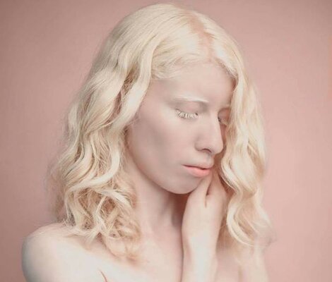 Miniatura: Ruby Vizcarra, modelka-albinoska z Meksyku