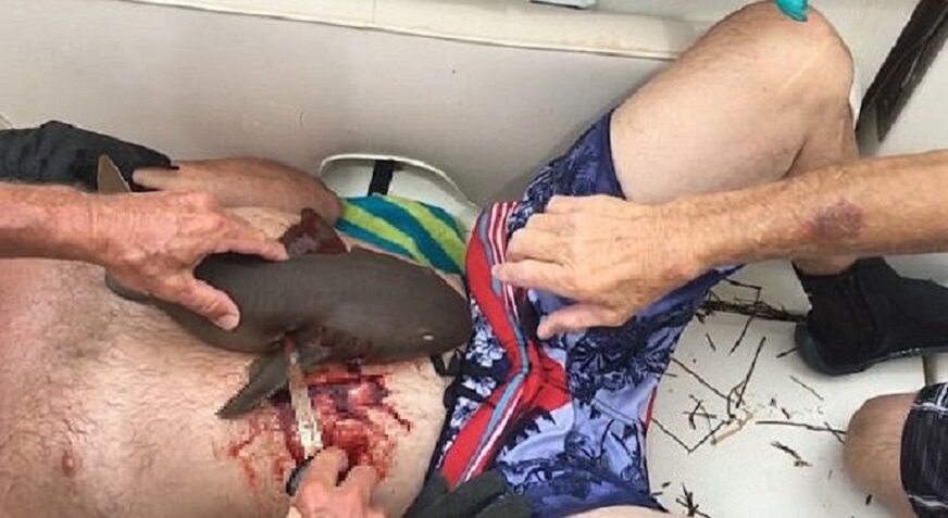Rekin wgryzł się w brzuch mężczyzny 
