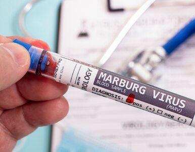 Miniatura: Czy wirus Marburg zagraża Europie? W...