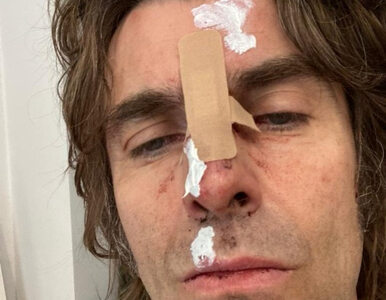 Miniatura: Liam Gallagher przeraził fanów zdjęciem...