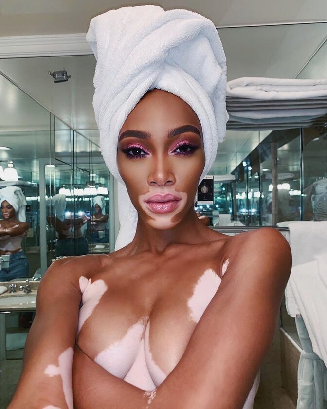 Winnie Harlow 