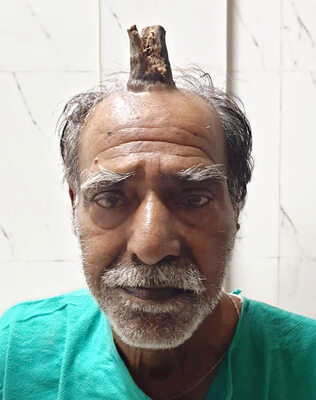 Miniatura: Mężczyzna z rogiem na głowie