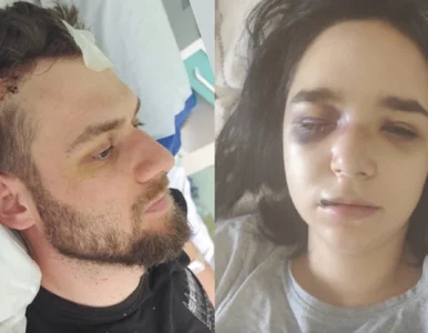 Miniatura: Znajomy celowo wjechał w nich samochodem....