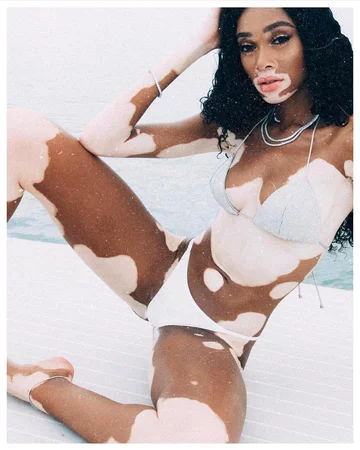 Winnie Harlow 