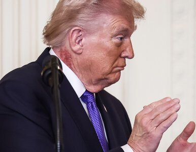 Miniatura: Zdrowie Donalda Trumpa pod lupą. Chodzi o...