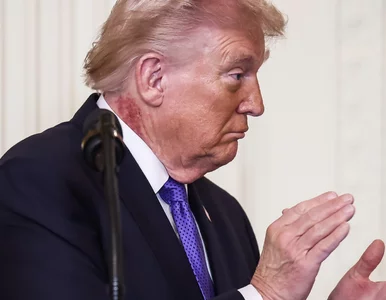 Miniatura: Zdrowie Donalda Trumpa pod lupą. Chodzi o...