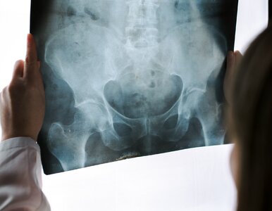 Miniatura: Przełom w diagnostyce wrodzonej wady...