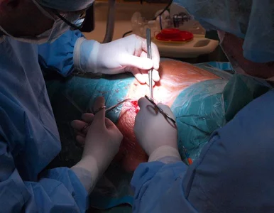 Miniatura: Ilu chorych Polaków nie doczeka przeszczepu?