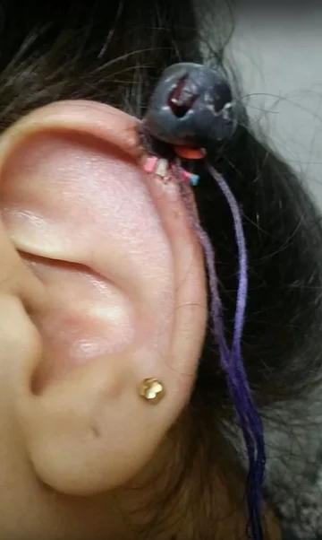 Metoda gumki recepturki 