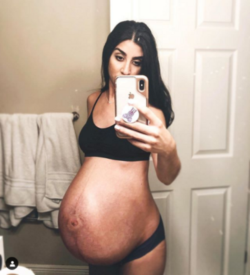 Miniatura: Po ciąży bliźniaczej jej ciało...