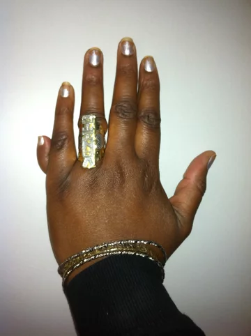 Lewa dłoń osoby z polidaktylią 