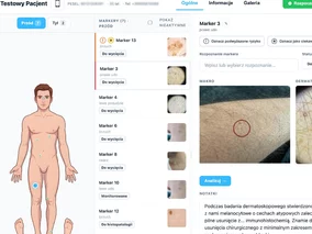 Miniatura: Smartfon pomoże ocenić zmianę...