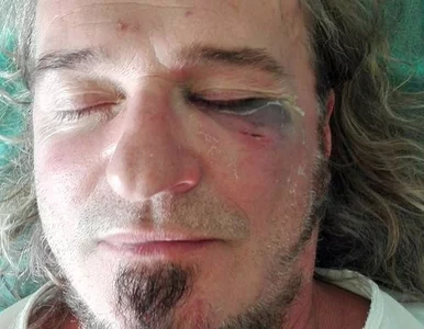 Miniatura: Wokalista Oddziału Zamkniętego został...