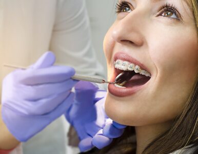 Ortodonta – kim jest, co robi i jak wygląda wizyta?