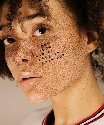 Miniatura: Osoby z albinizmem i zmianami skórnymi...