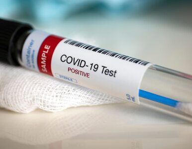 Miniatura: 340 nowych przypadków koronawirusa w...