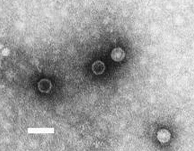 Miniatura: Groźny wirus odnaleziony w Brazylii