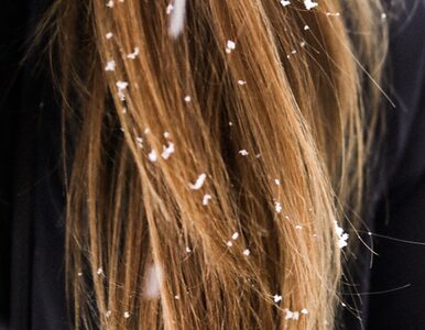 Miniatura: Jak chronić włosy przed mrozem? O to warto...