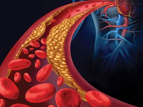 Miniatura: Cholesterol, czyli cichy zabójca. Eksperci...