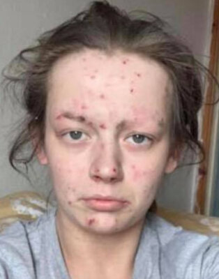 Miniatura: Była uzależniona od narkotyków, przeszła...